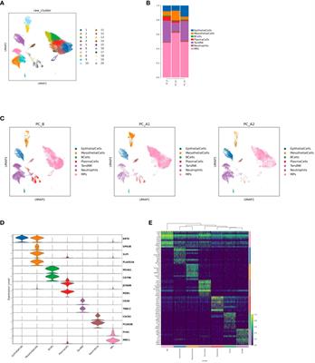 Effect of sodium stibogluconate in recruiting and awakening immune cells in the pleural fluid of pancreatic cancer: preparation for immunotherapy